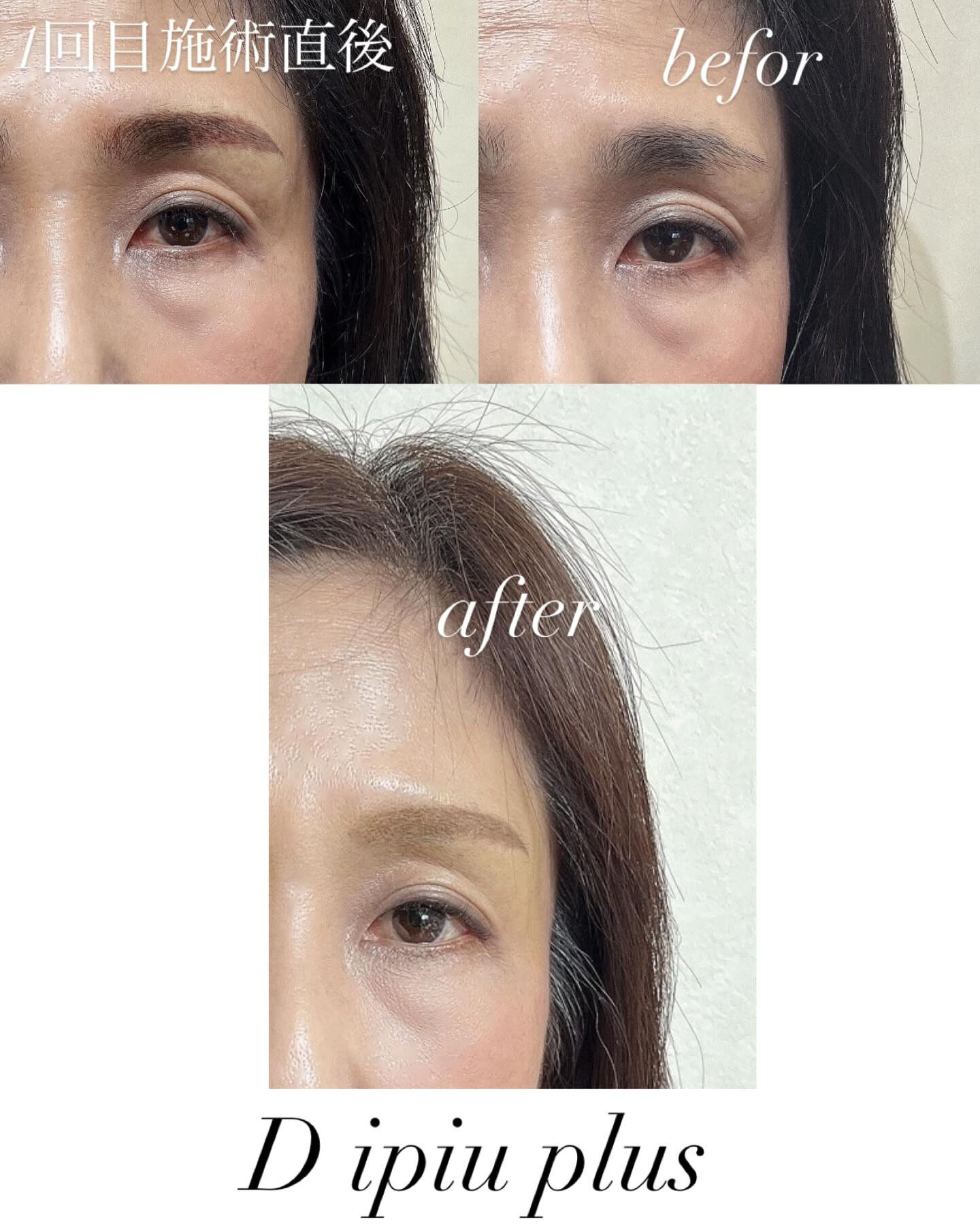 薄くふんわりした眉にしたいとご要望あり