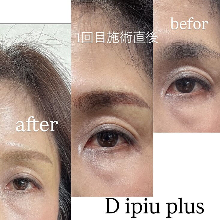 薄くふんわりした眉にしたいとご要望ありましたが、濃いめの自眉