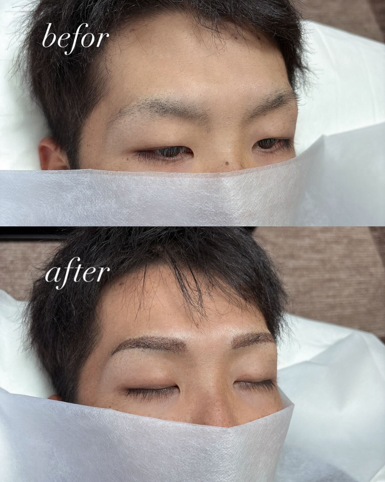 1回目施術直後になります✨