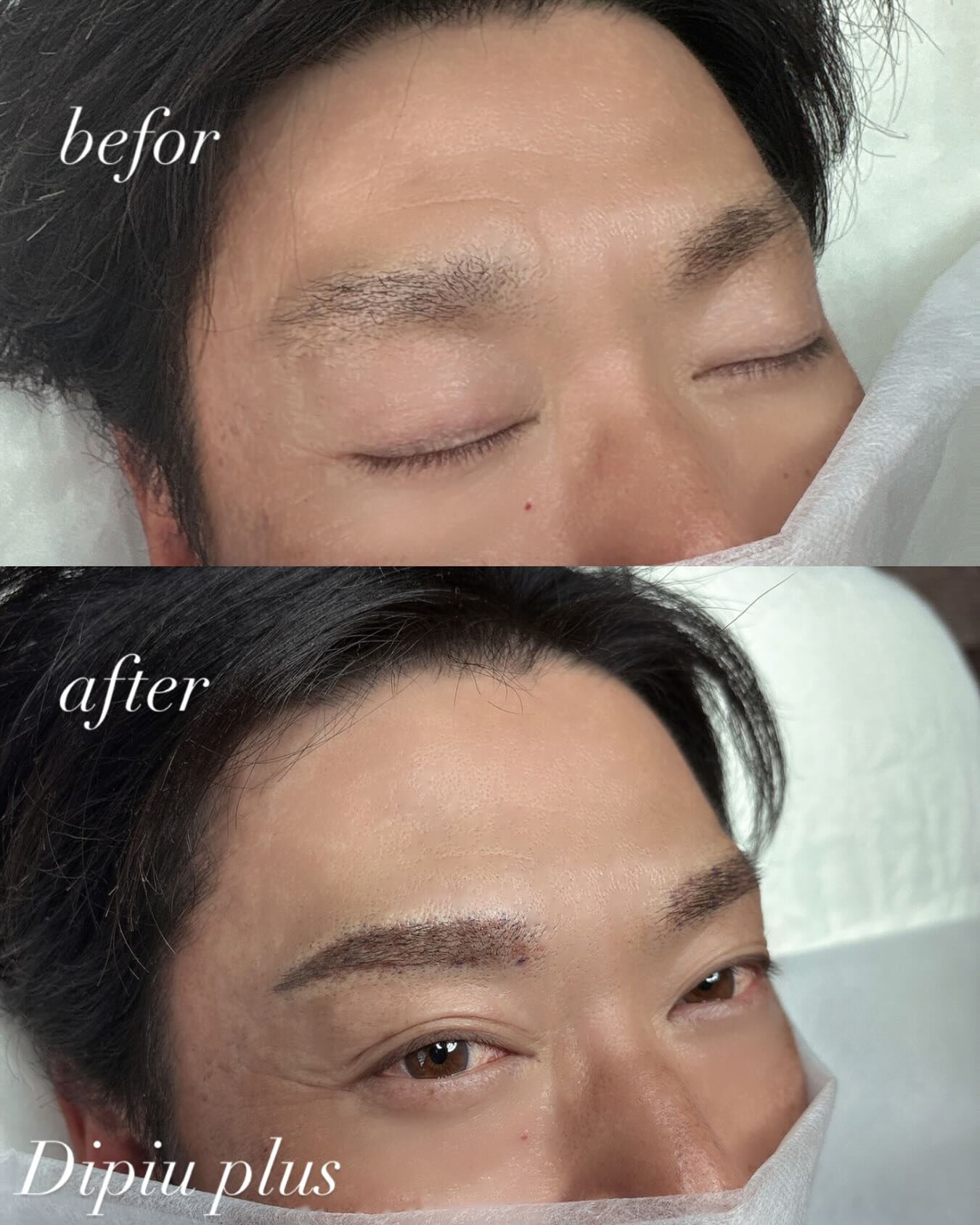 眉の悩みは女性だけでなく、男性にとっても同じです